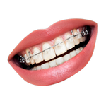 teeth in spanish